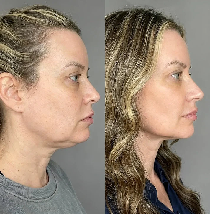Megan, 44