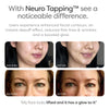 Illu Neuro Tapping