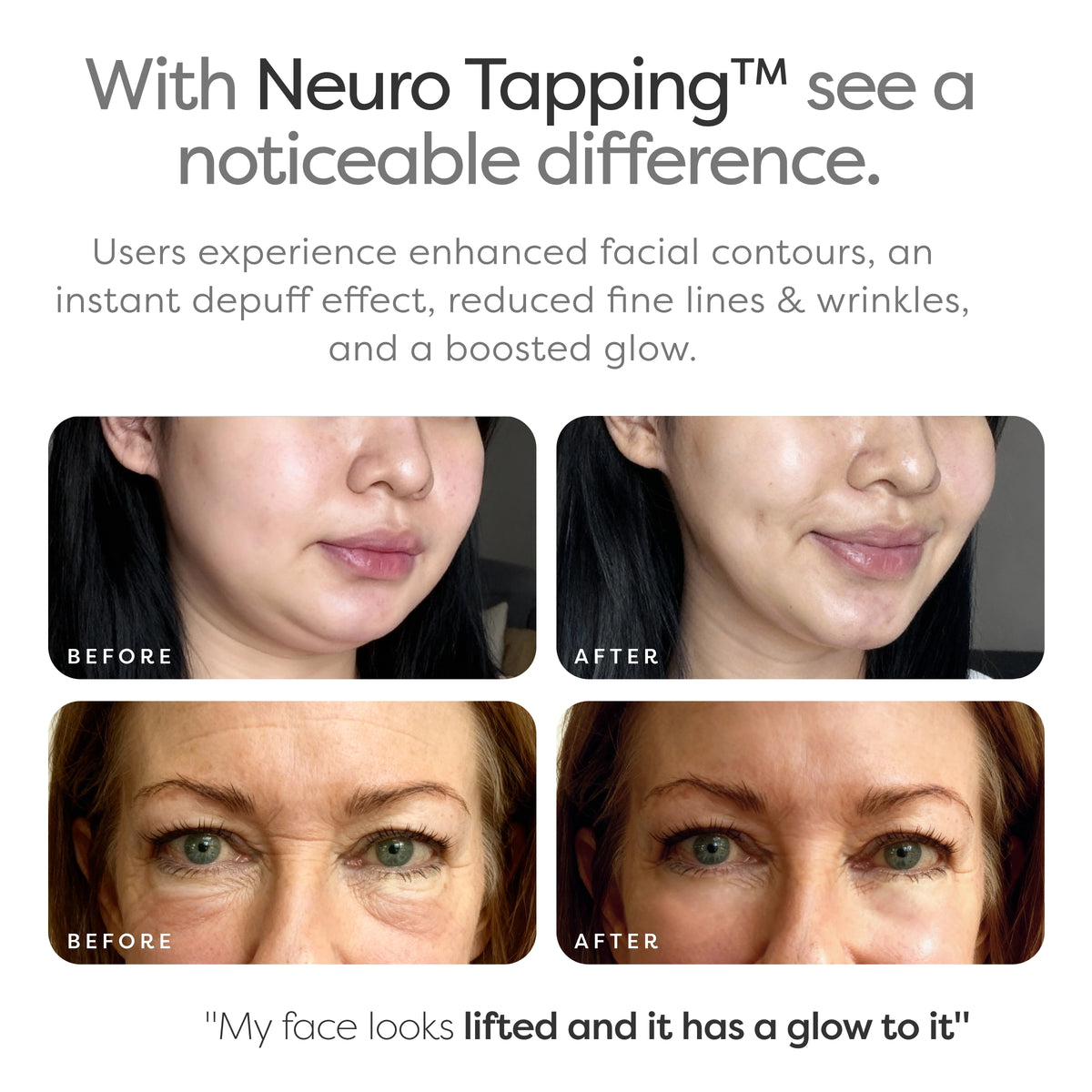illu Neuro Tapping