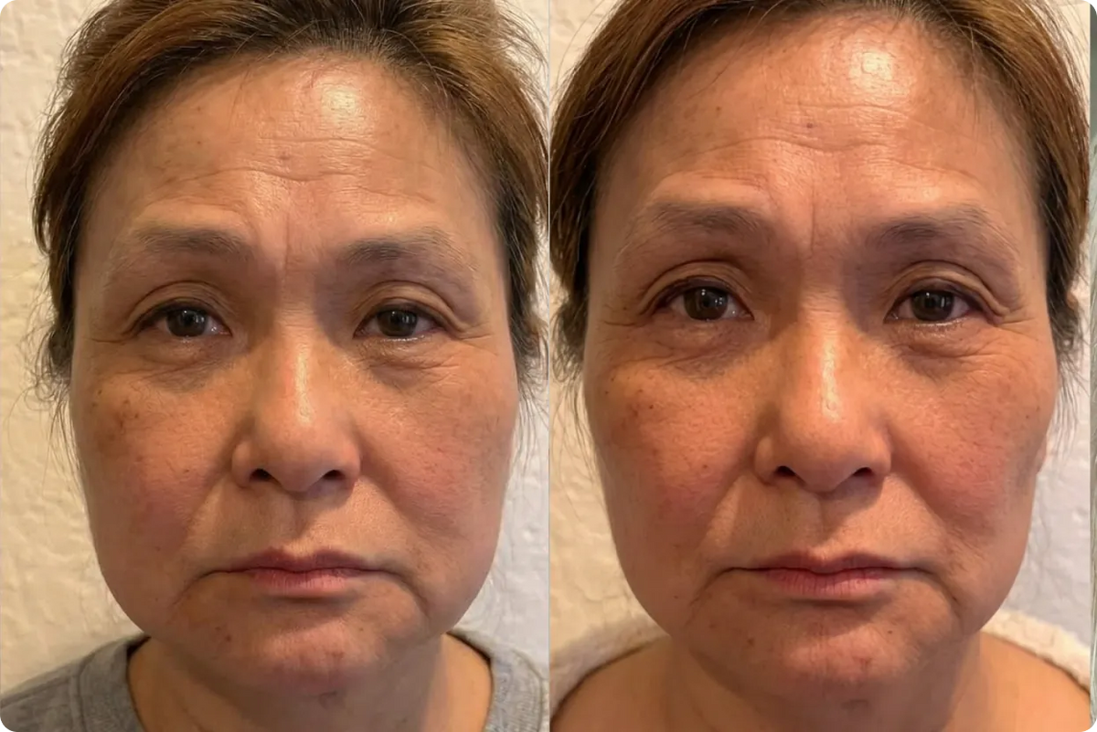 Leina Z, 55