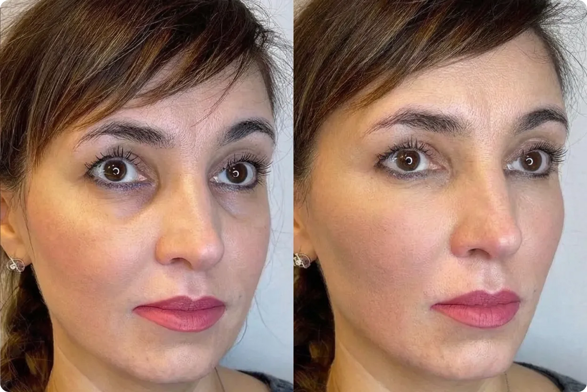 Susan Jones, 48